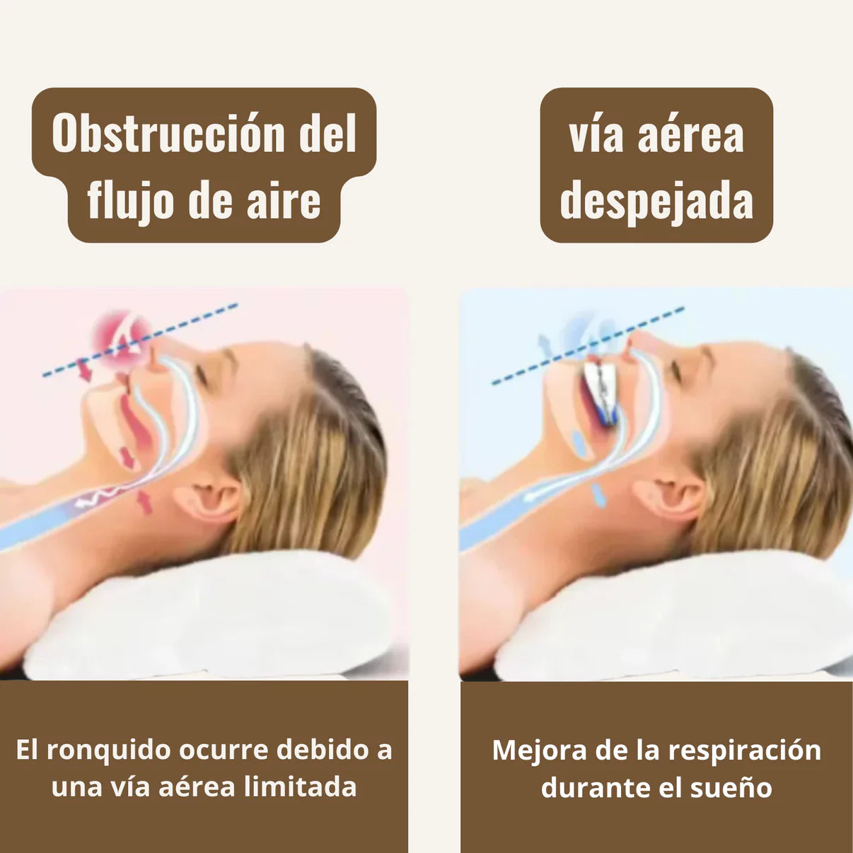 Protector bucal antirronquido SILENTSLEEP™